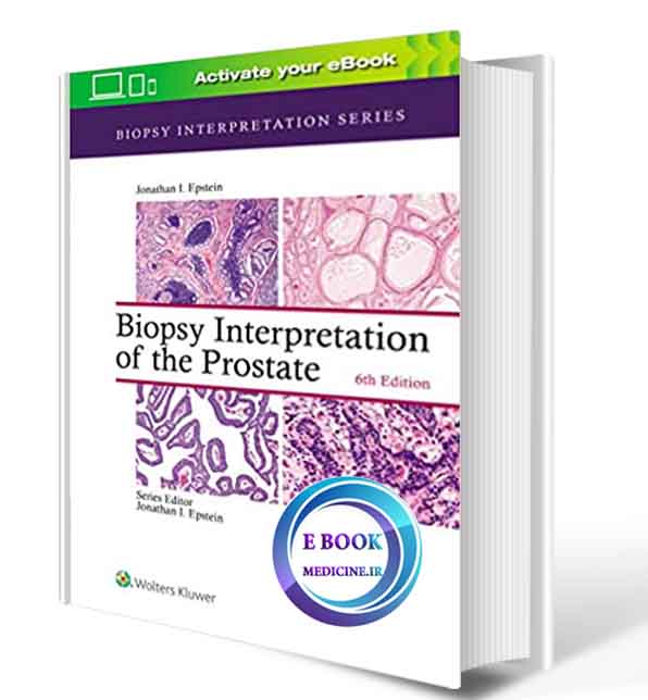 دانلود کتابBiopsy Interpretation of the Prostate  6th Edition 2020 (  PDF)